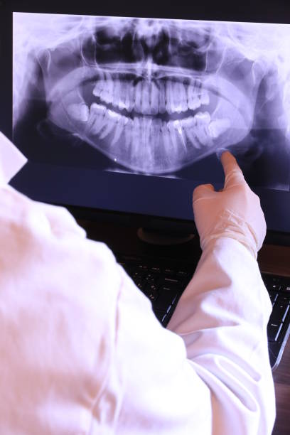 Best Emergency Wisdom Teeth Removal in Sterling Heights, MI